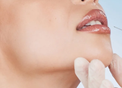 Profesyonel Dolgu Uygulamaları (Dudak, Çene, Yüz)