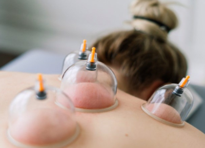 Geleneksel Hacamat Tedavisi (GETAT)