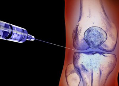 Eklem İçi Enjeksiyon Tedavileri